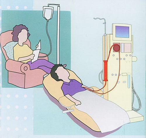 重庆推广腹膜透析技术 切实提高尿毒症治疗率