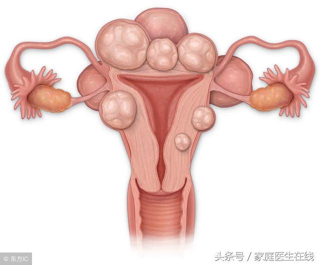 宫颈癌晚期能活多久?关键要做到这两点,现在知道还不晚