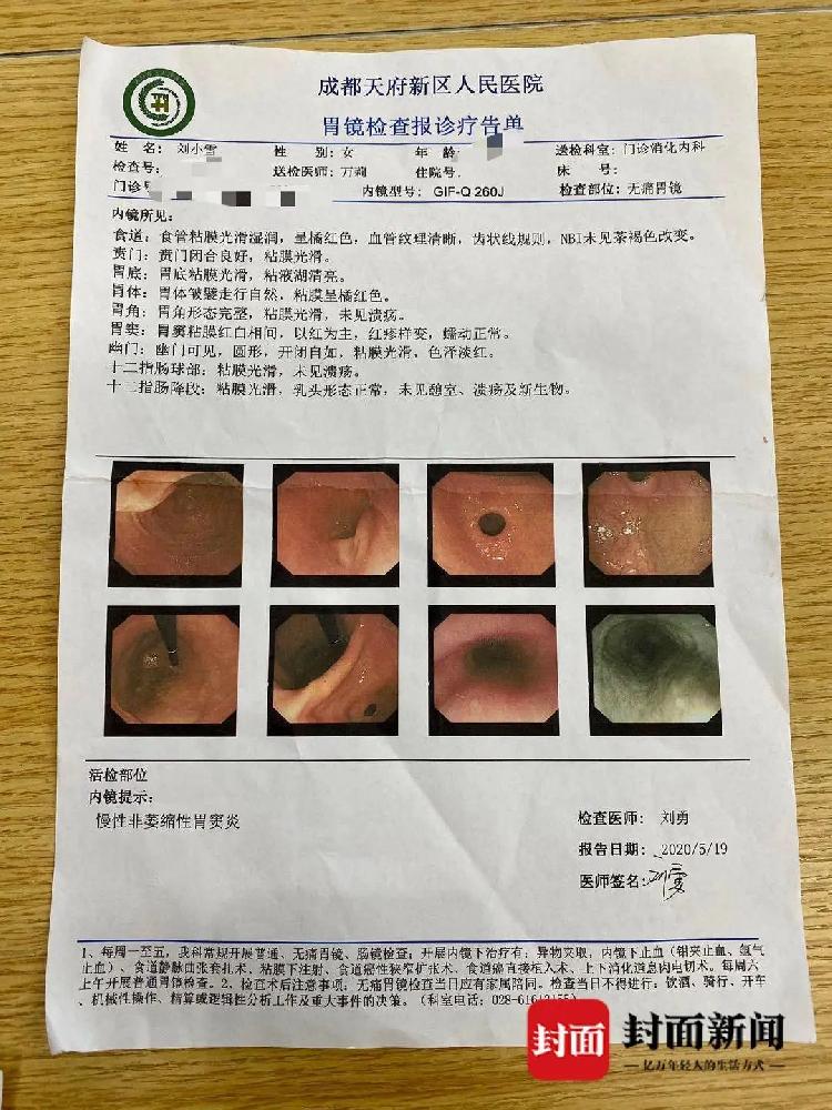 12天后刘小雪的胃镜结果