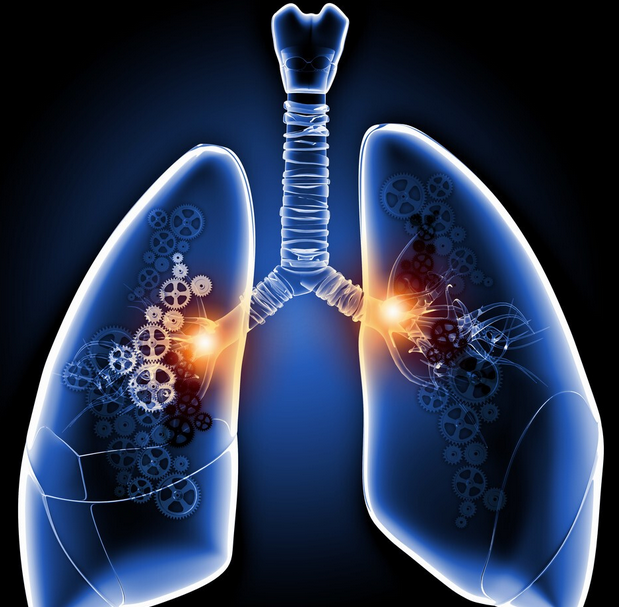 肺肿瘤和肺癌的区别有哪些?