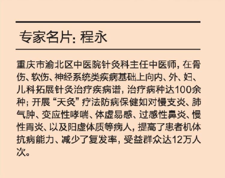 重庆好医生系列报道程永一根针一个穴位一个人一颗仁心