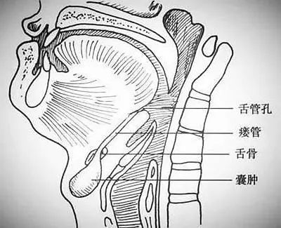 喉结图 解剖图图片