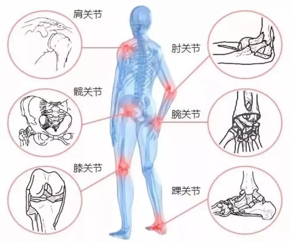 肌肉,骨骼,关节疼痛查不出原因?