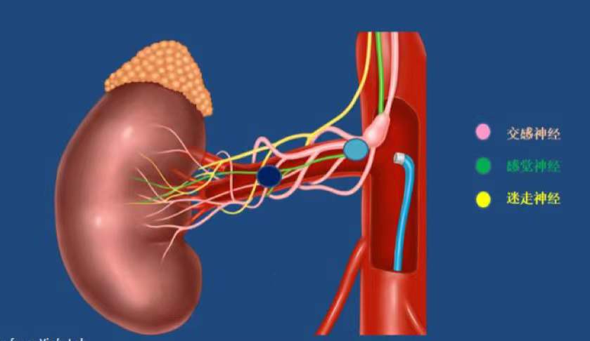 除了手術主要的消融靶點交感神經之外,還分佈有副交感神經,交感神經