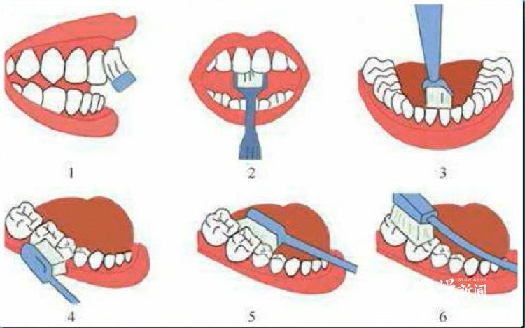 刷牙过程中又有哪些注意事项?口腔专家告诉你答案