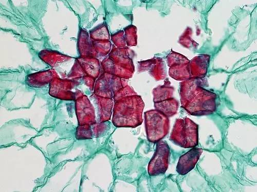 梨果肉石细胞图图片
